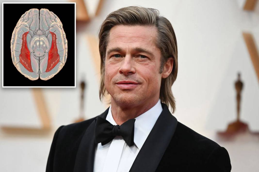 Brad Pitt'in Hastalığı Prosopahnasia Türkiye'de De Çıktı 9